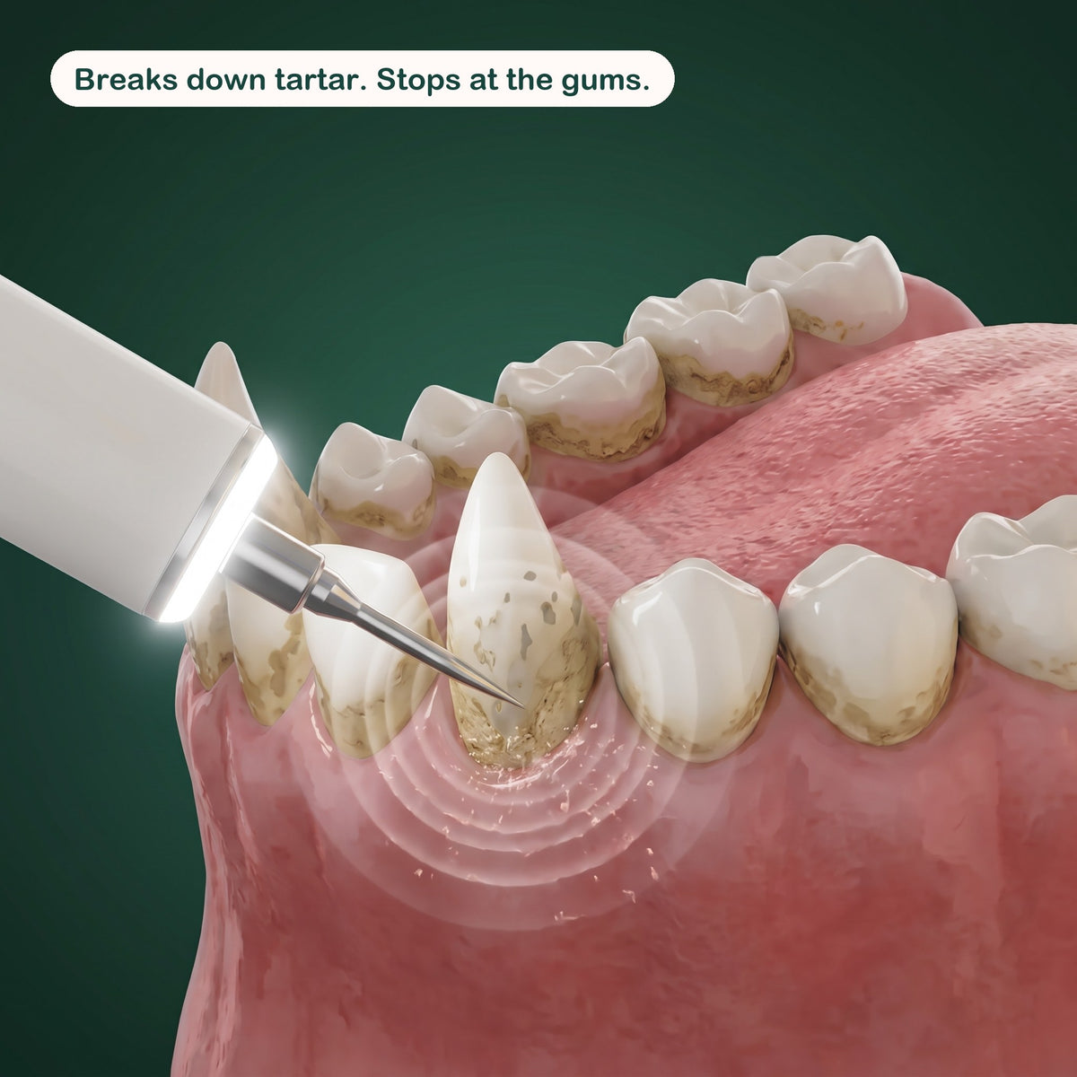 PetRoot™ Silent Ultrasonic Dental Kit